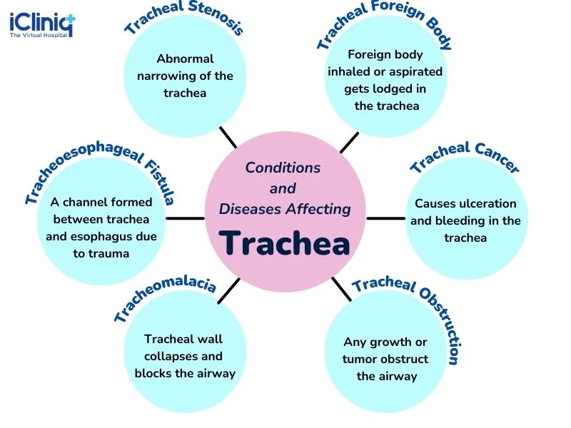 Conditions and diseases affecting trachea