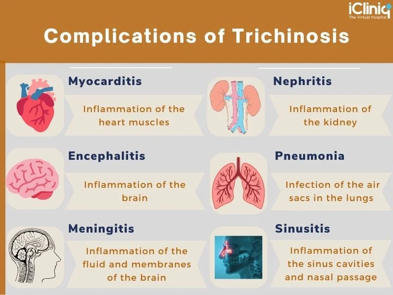 Complications