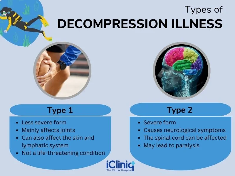 Types of decompression illness Types of decompression illness