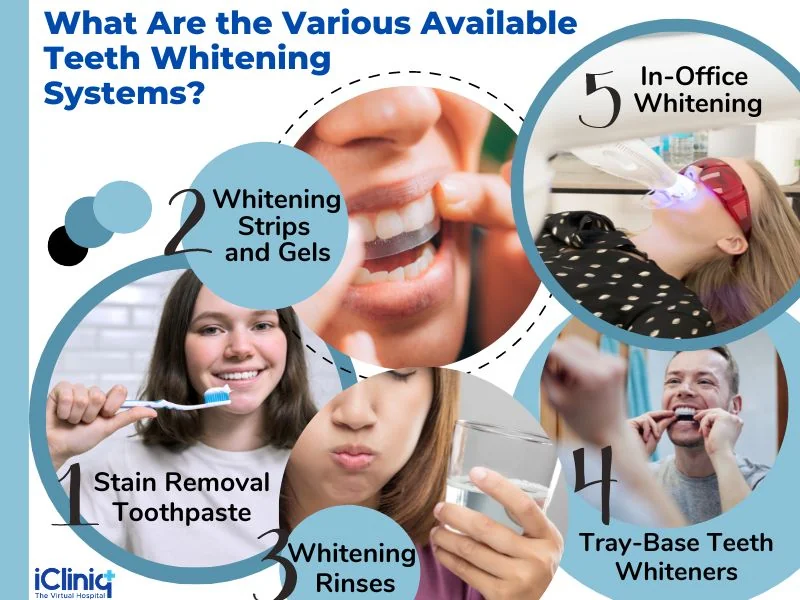 Available teeth whitening systems