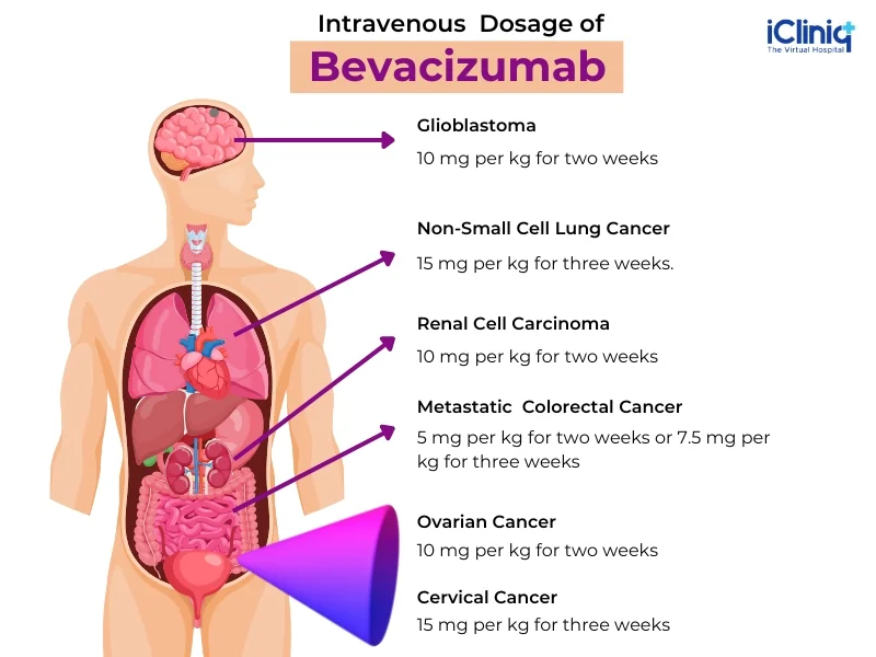 intravenous-dosage-of-bevacizumab