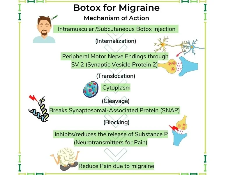 Botox Work for Migraines