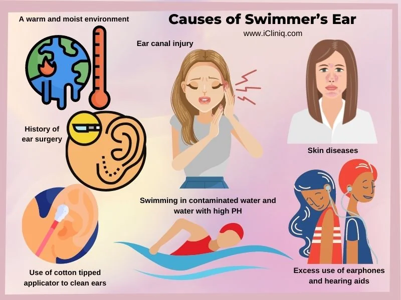 causes-swimmers-ear