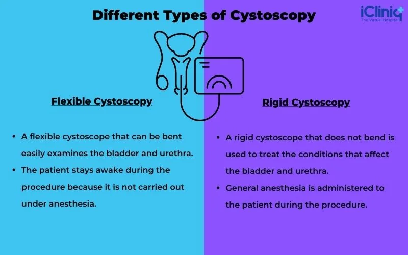 Different Types of Cystoscopy