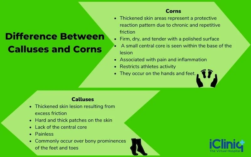 difference-between-calluses-and-corns
