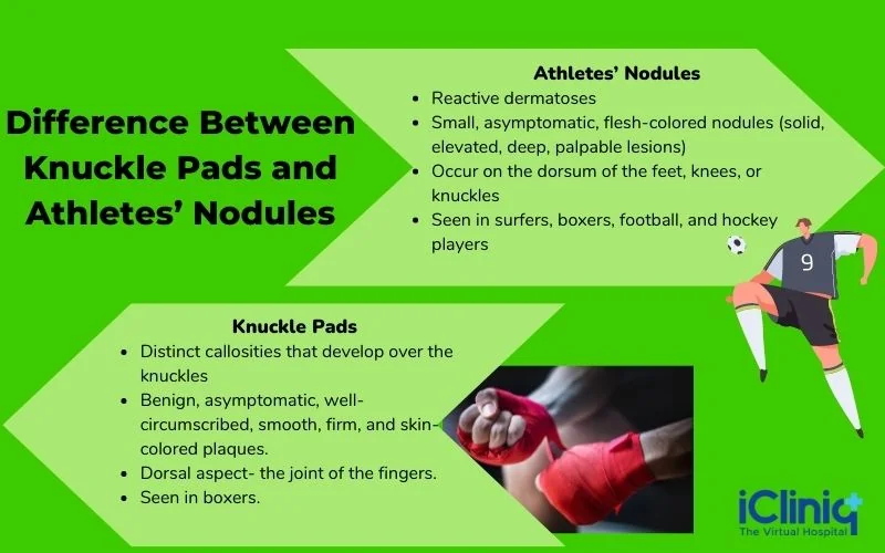 difference-between-knuckle-pads-and-athletes-nodules