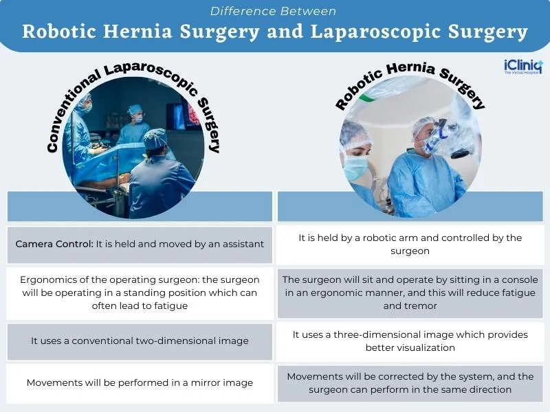 Difference Between Robotic Hernia Surgery and Laparoscopic Surgery