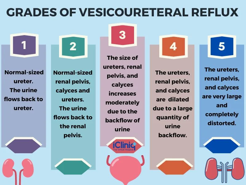 different-grades-of-vesicoureteral-reflux different-grades-of-vesicoureteral-reflux