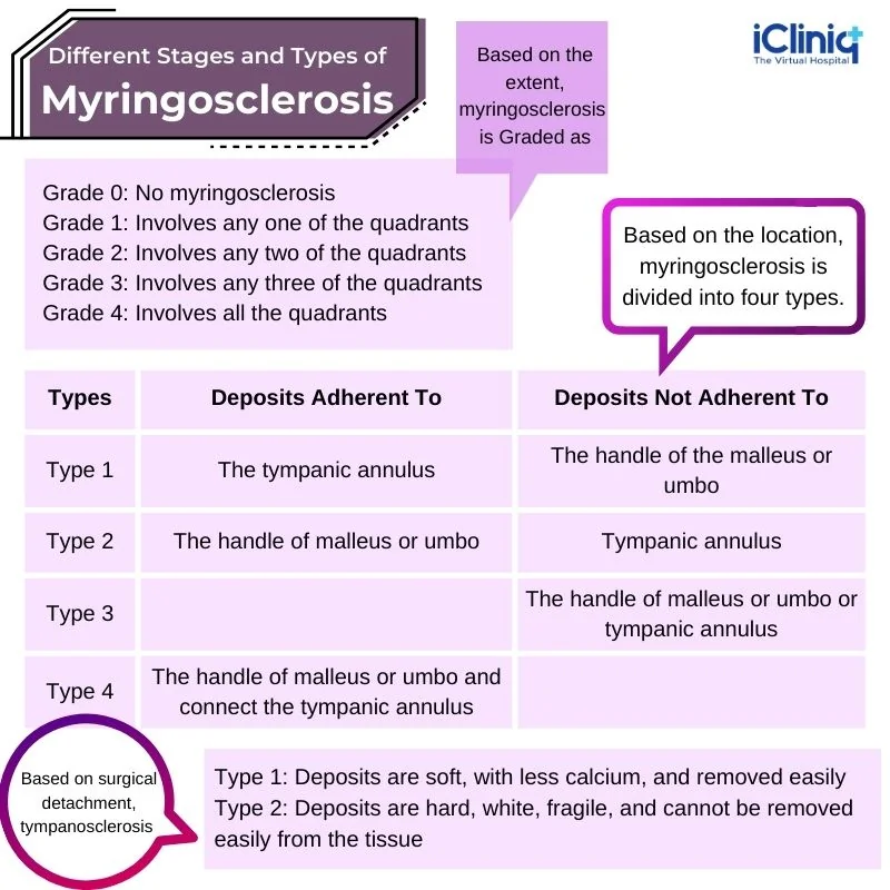 different-stages-and-types-of-myringosclerosis