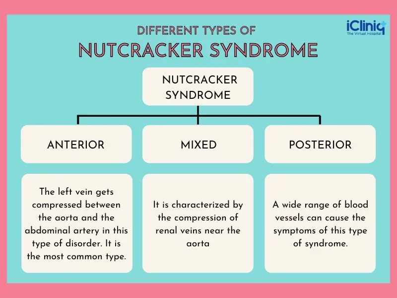 Different Types of Nutcracker Syndrome
