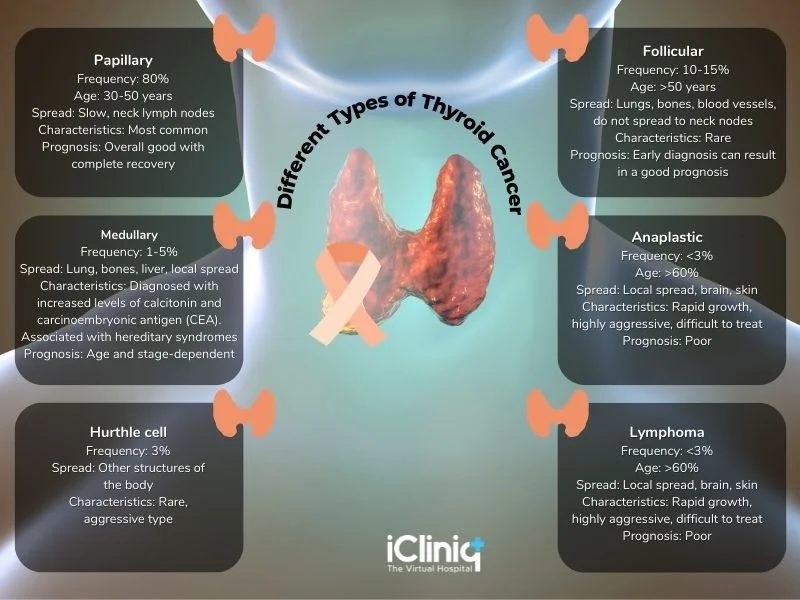 different-types-of-thyroid-cancer