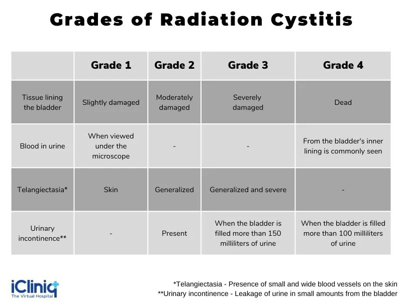 different-grades-of-radiation-cystitis