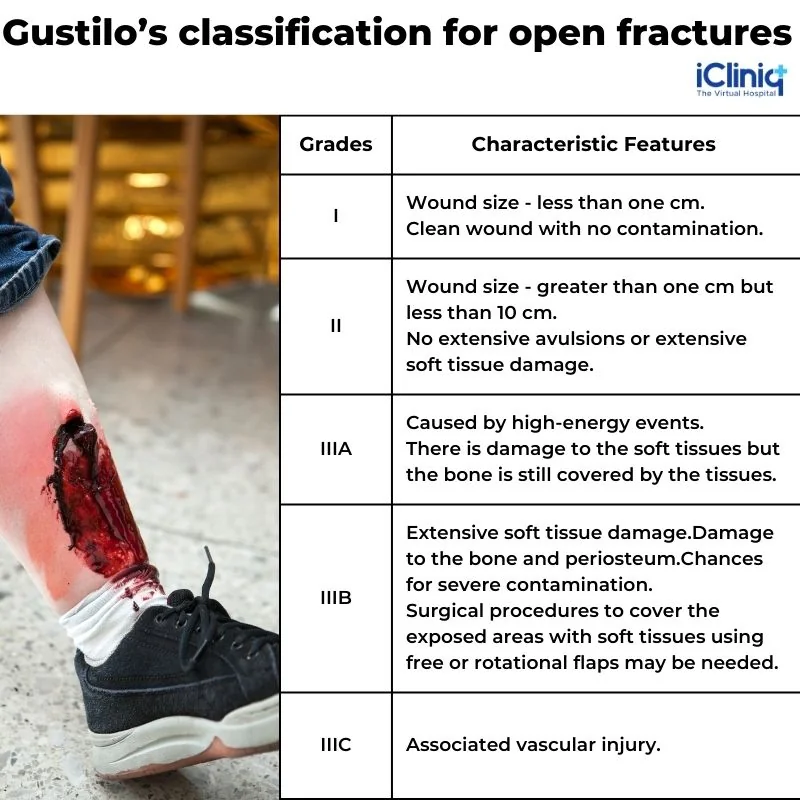 injury-based-on-gustilo-classification