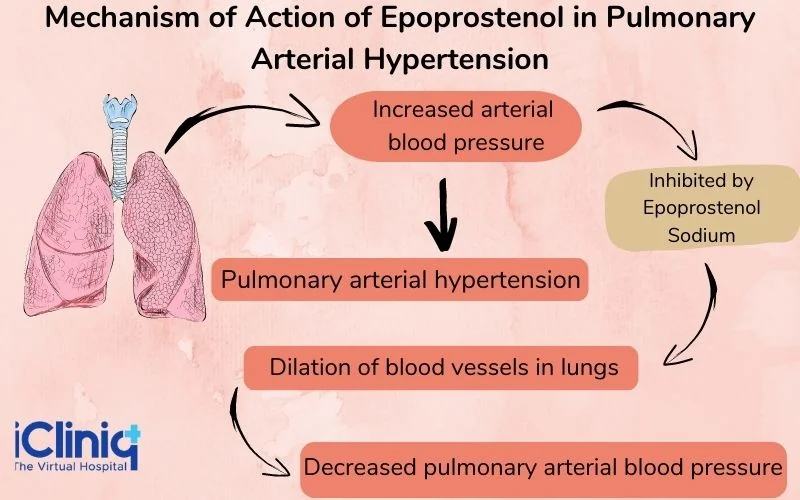 mechanism-of-action-of-epoprostenol-in-pulmonary-arterial-hypertension