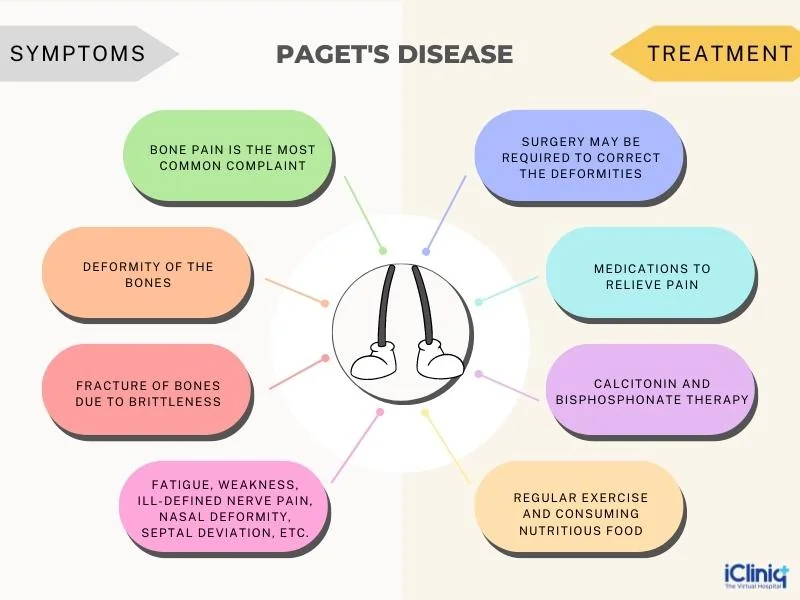 Paget’s disease