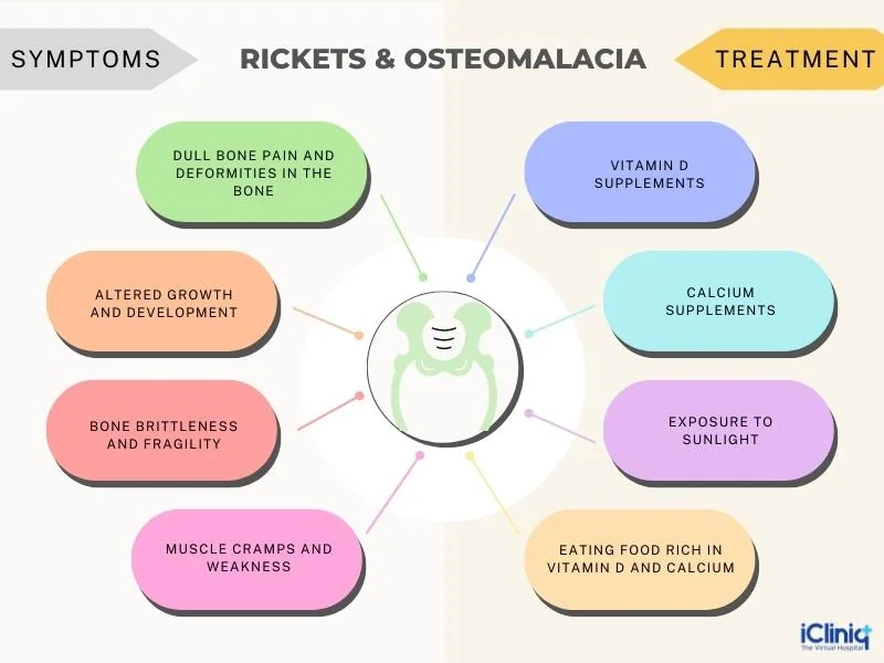 Rickets and Osteomalacia