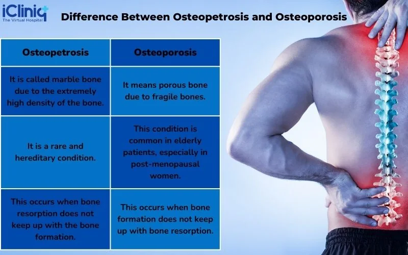 difference-between-osteopetrosis-and-osteoporosis difference-between-osteopetrosis-and-osteoporosis