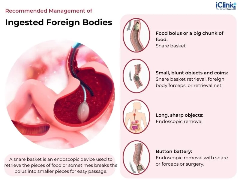 recommended-management-of-ingested-foreign-bodies recommended-management-of-ingested-foreign-bodies