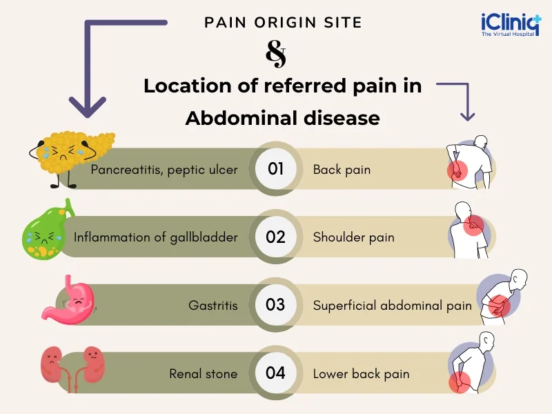 Referred Abdominal Pain Referred Abdominal Pain