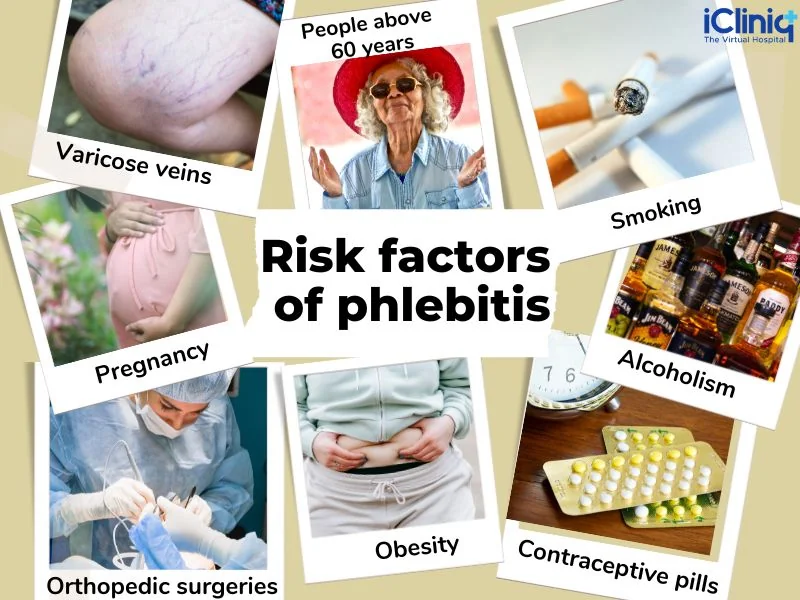 Risk factors of phlebitis Risk factors of phlebitis
