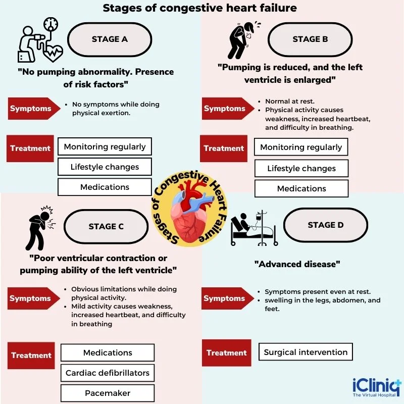 Stages of Congestive Heart Failure Stages of Congestive Heart Failure