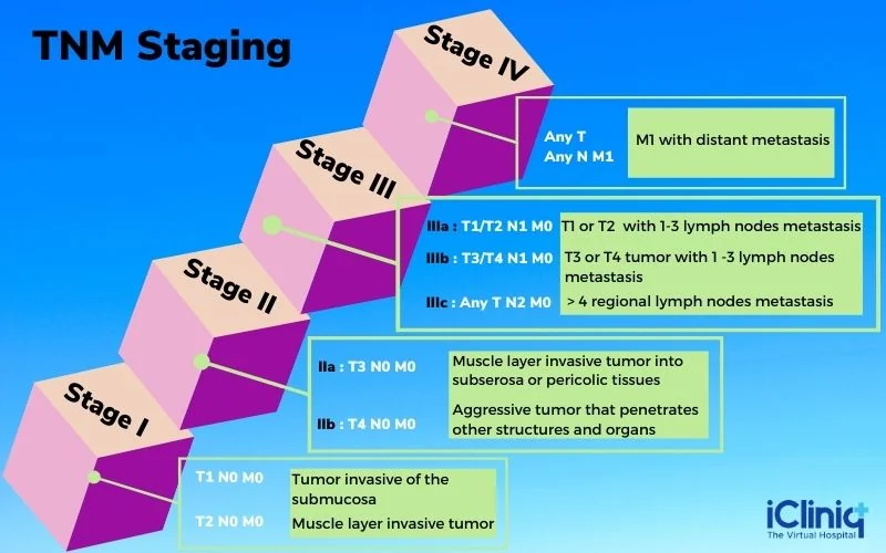 cancer-staging