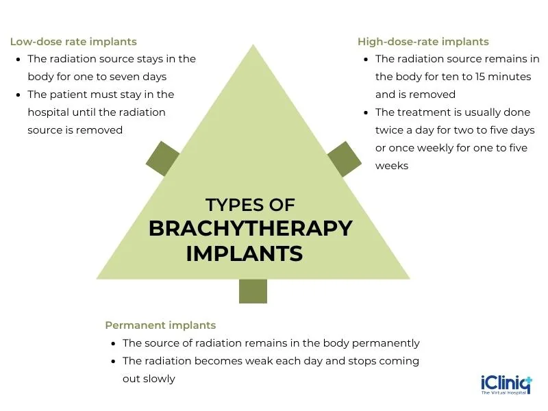 Different Types of Brachytherapy