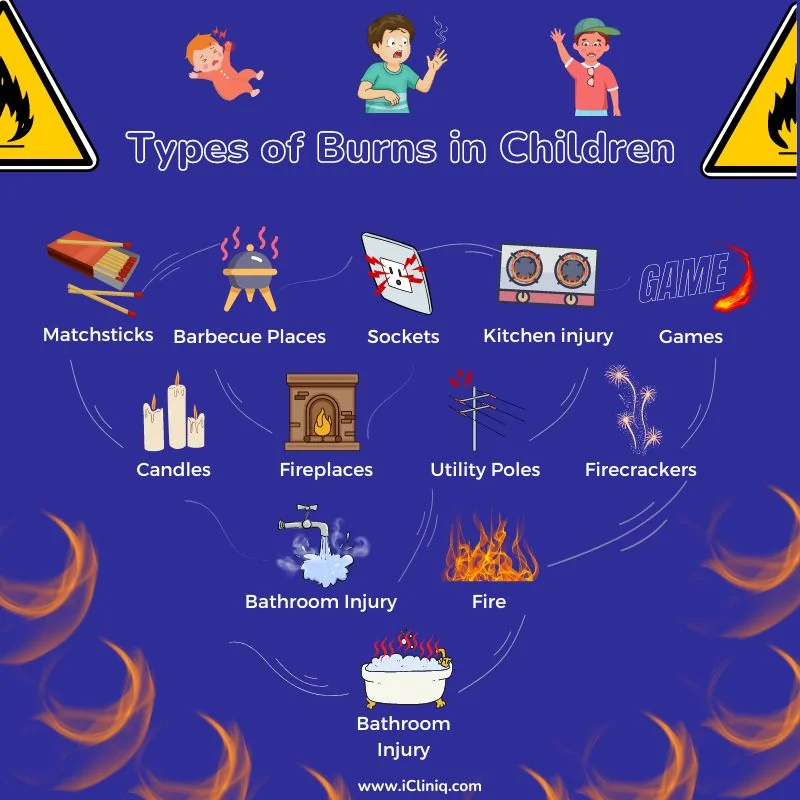 types-of-burns-in-children