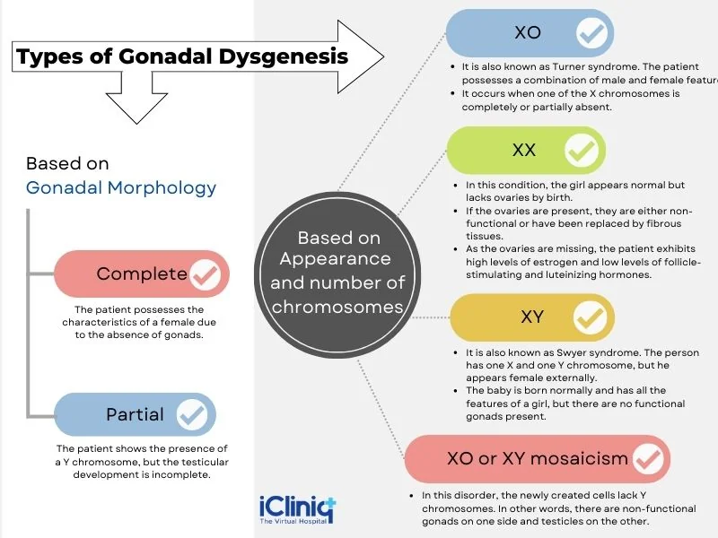 types-of-gonadal-dysgenesis