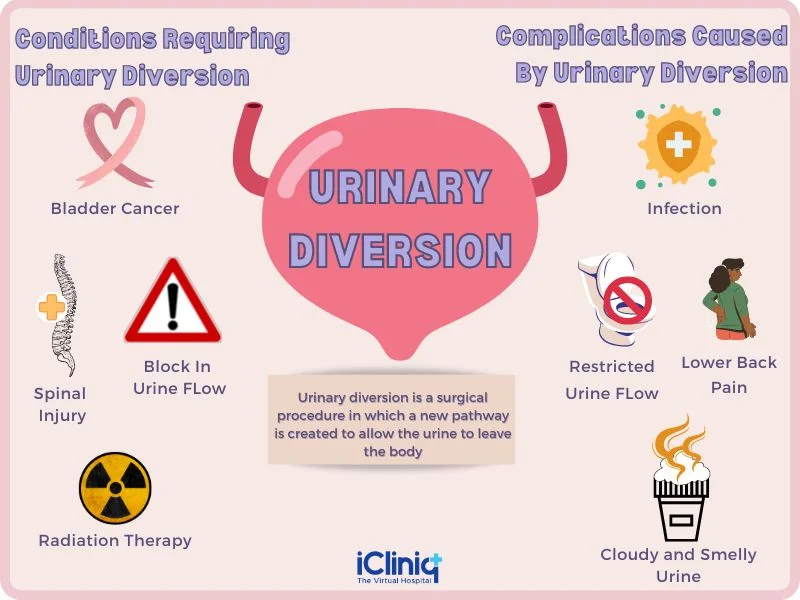 urinary-diversion