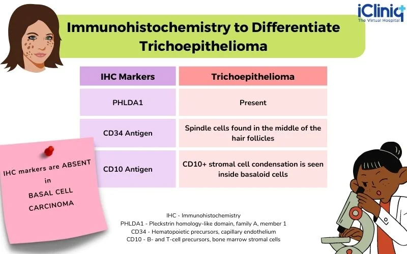 used to differentiate trichoepithelioma from basal cell carcinoma used to differentiate trichoepithelioma from basal cell carcinoma