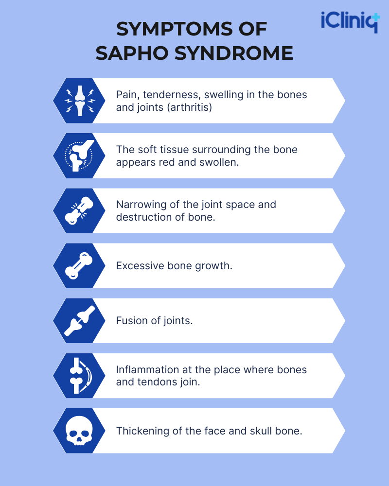 Symptoms of SAPHO Syndrome